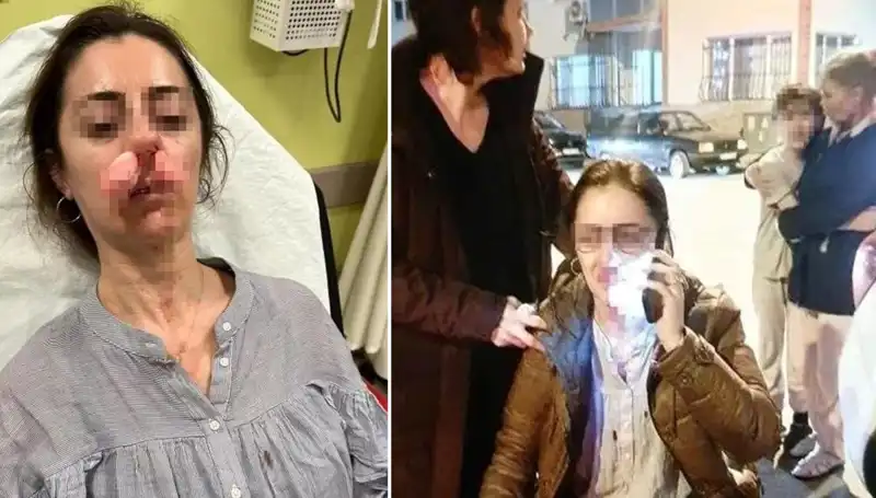 Eşinin Sevgilisi Sandığı Adam Otomobil Kapısıyla Saldırdı!