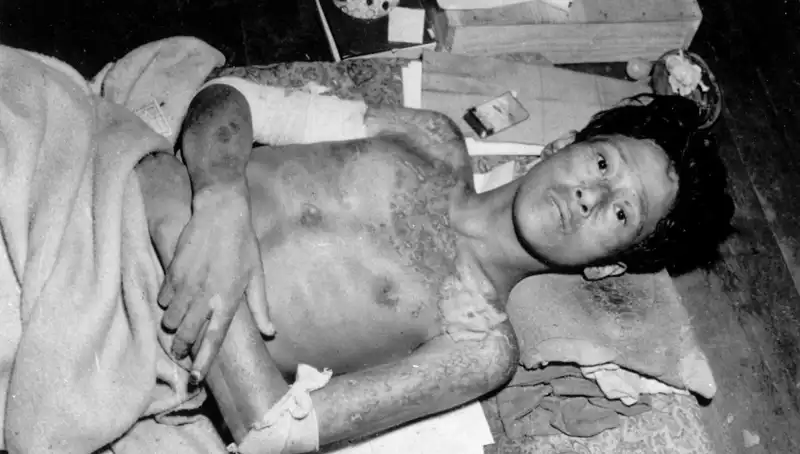 Nagasaki'den 80 yıl sonra gelen uyarı: Nükleer felaket riski artıyor!