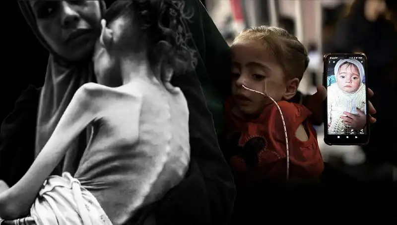 Küçük Meryem'in Açlıkla Mücadelesi: 25 Kilodan 10 Kiloya Düşüş